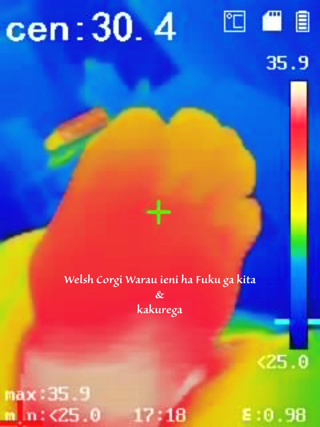 施術後40代女性T様の足