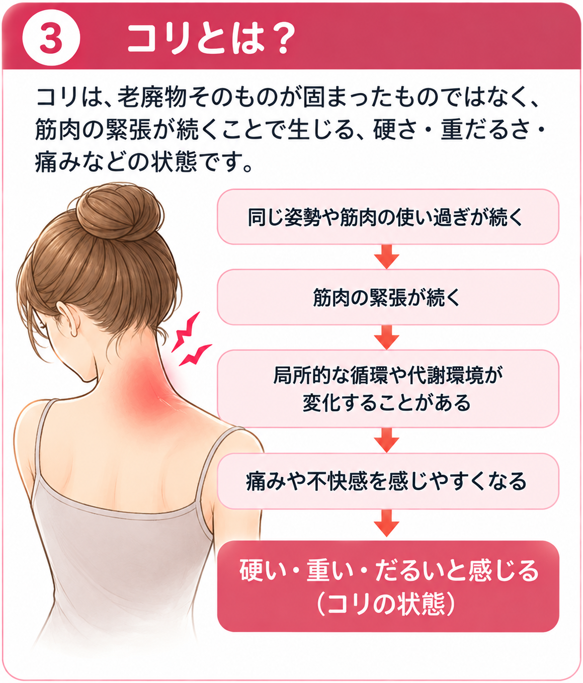 首や肩の筋肉の緊張とコリの状態を示すイメージ図
