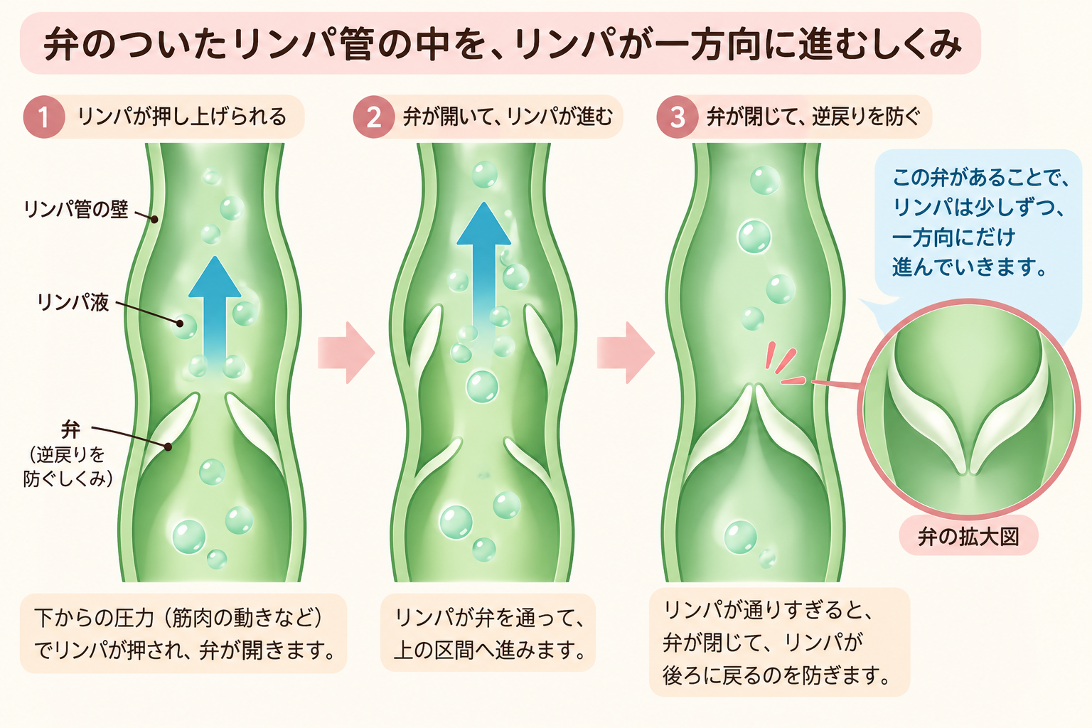 弁のついたリンパ管の中を、リンパが一方向に進む図