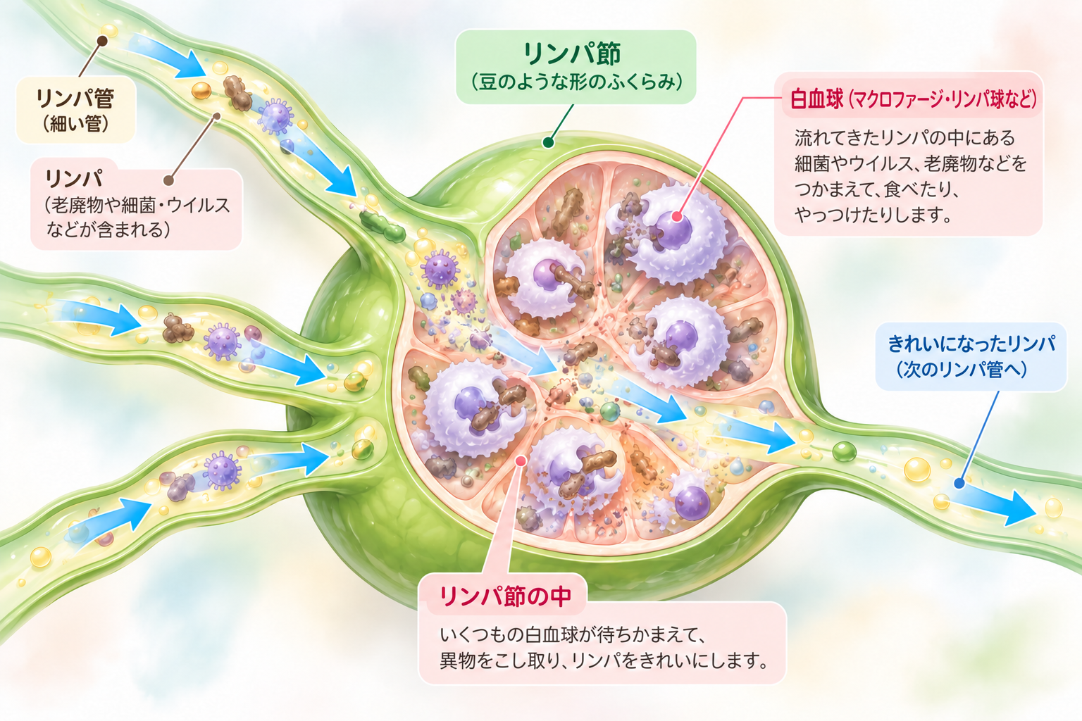 豆の形のリンパ節に、何本もの細い管からリンパが入り、中で白血球が細菌をつかまえて、きれいになったリンパが出ていく図