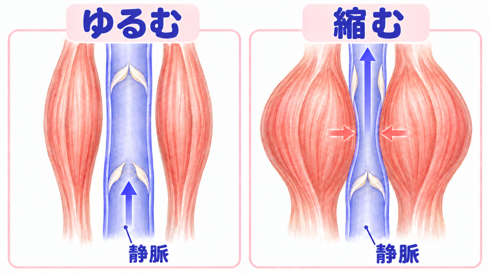 ふくらはぎの筋肉が縮むと、静脈が押されて血液が上へ送られる図